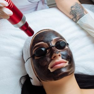 Hollywood peeling
